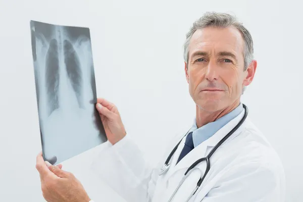 Serious doctor with x-ray picture of spine in office — Stock Photo, Image