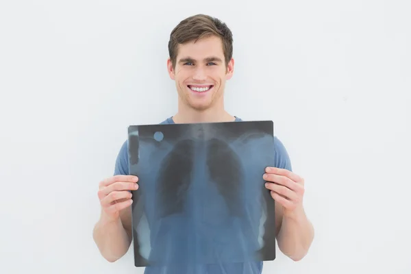 Portrait of a smiling young man holding lung x-ray — Stock Photo, Image