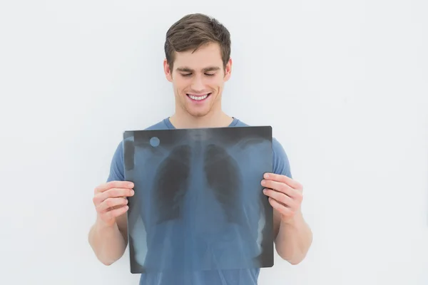 Portrait of a smiling young man holding lung x-ray — Stock Photo, Image