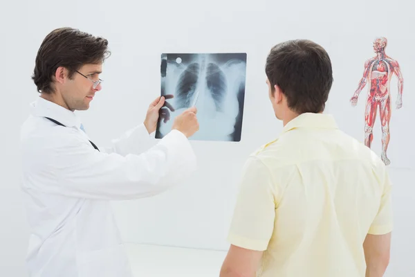 Médecin masculin expliquant la radiographie de la colonne vertébrale au patient — Photo