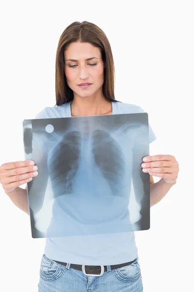 Портрет серьезной молодой женщины, держащей рентген легких — стоковое фото