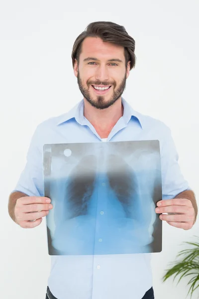 Portrait of a smiling young man holding lung x-ray — Stock Photo, Image