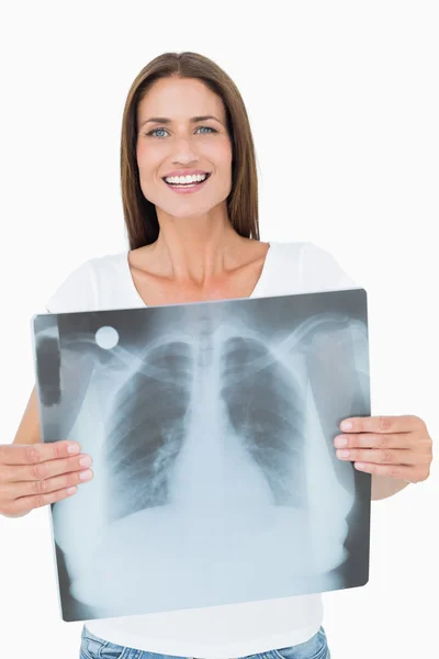 Retrato de uma jovem sorridente segurando radiografia pulmonar — Fotografia de Stock