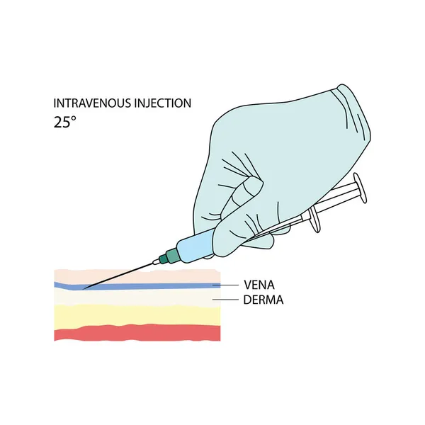 静脉注射Intravenous Injection 对人类和动物使用的有效的药物和其他医疗解决方案的管理方法 在白色背景上孤立的矢量图解 用于设计和网络 — 图库矢量图片