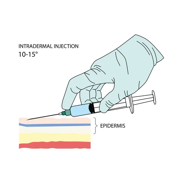 Intradermális Injekció Embereknél Állatoknál Alkalmazott Gyógyszerek Más Orvosi Megoldások Hatékony — Stock Vector