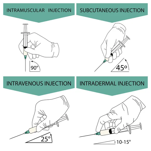 如何正确地进行注射 不同类型注射器的信息图形 带注射器的戴着手套的手在白色背景上孤立的矢量图形 用于设计和网络 — 图库矢量图片