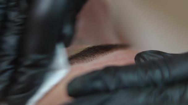 Close Hand Gloves Removing Pigment Leftovers Female Caucasian Skin Beauty — стоковое видео