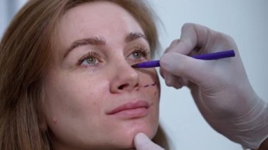 Doctor hand makring skin tightening under eye of Caucasian woman indoors. Unrecognizable expert plastic surgeon in gloves drawing on face of patient. Face contouring concept