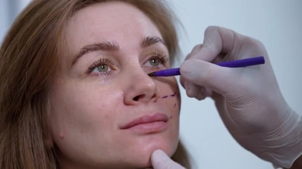 Doctor Hand Makring Skin Tightening Eye Caucasian Woman Indoors Unrecognizable — 비디오
