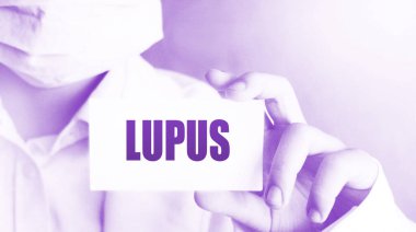 Doktor 'un elinde lupus kelimesi var. Tıbbi konsept.