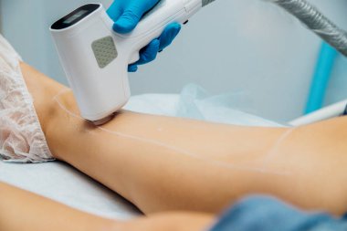 Lazer saç çıkarma işleminden önce şeffaf jel kullanımı. Şekerleme işlemi için şeker macunu uygulaması. Cilt bakımı, kozmetik işlemler. Kadın bacakları. Güzellik salonu.
