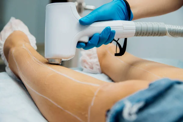 The procedure of laser hair removal of women\'s legs. Application of sugar paste for the sugaring procedure. Skin care, cosmetic procedures.