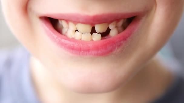 Улыбка Ребенка Потерявшего Молочный Зуб Уход Зубами Детей — стоковое видео