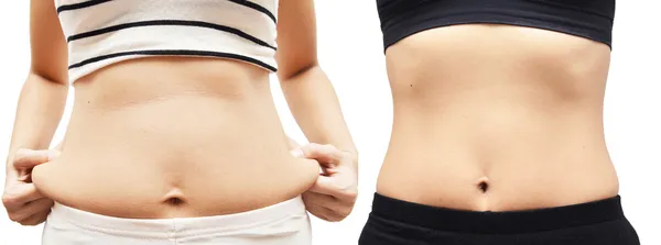 Before after fat woman fitness — Stock Photo, Image