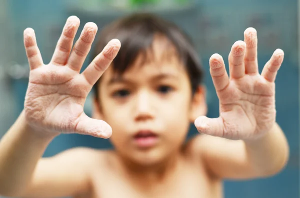 Niño mostrando la mano marchita después de la ducha — Foto de Stock