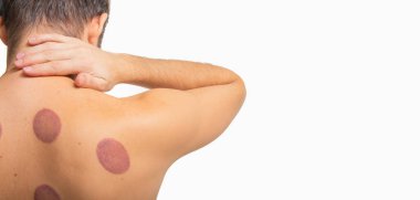 Boyun ağrısı olan bir adam. Geleneksel tıp. Arkasında teneke kutular olan işlem izleri.