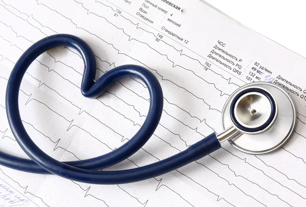 A blue stethoscope on a cardiogram — Stock Photo, Image