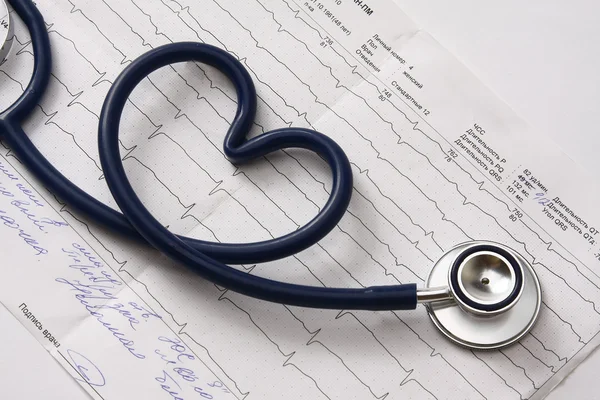 A blue stethoscope on a cardiogram — Stock Photo, Image