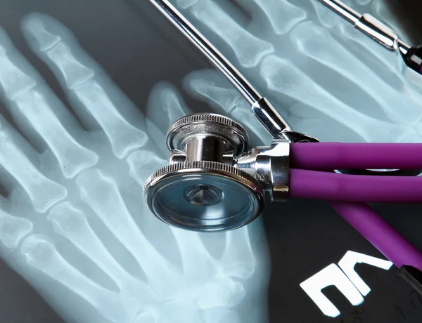 X-ray en stethoscoop. — Stockfoto