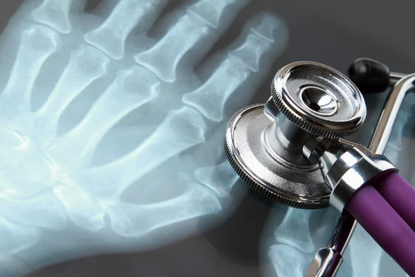 X-ray and stethoscope. — Stock Photo, Image