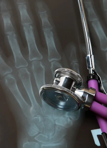 Stethoscope on an x-ray picture — Stock Photo, Image