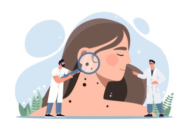 Cilt kanseri konsepti. Ellerinde büyüteç olan doktorlar kız derisini inceleyip melanom buluyorlar. Onkoloji ya da dermatolojik sorunlar. Çizgi film düz vektör çizimi