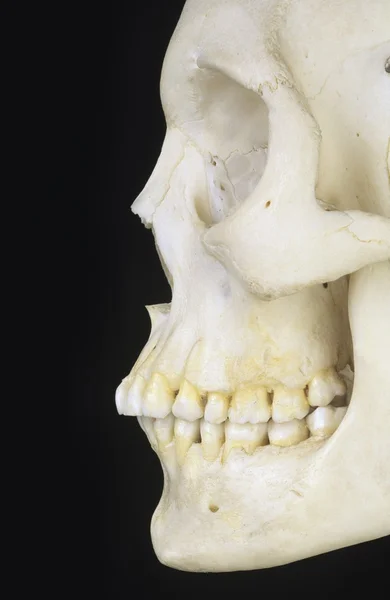 Vista lateral del cráneo humano — Foto de Stock