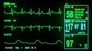EKG monitör ekran
