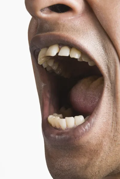 La bouche de l'homme grande ouverte — Photo