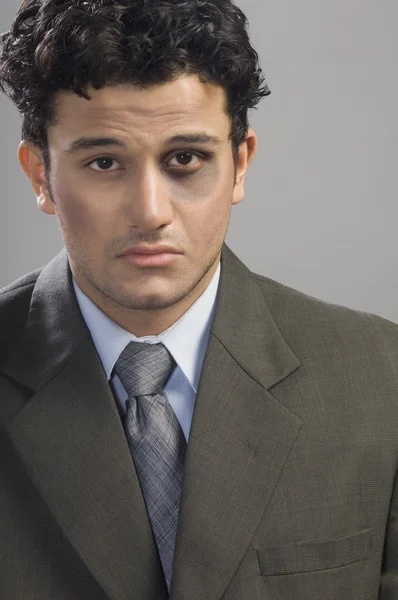 Bruised businessman looking sad — Stock Photo, Image