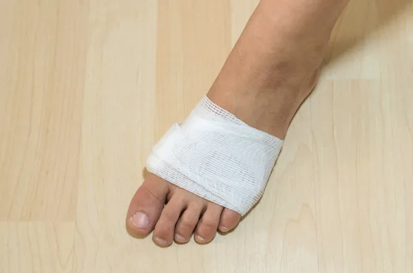 Bandaj de medicamente albe pe picior de leziune — Fotografie, imagine de stoc