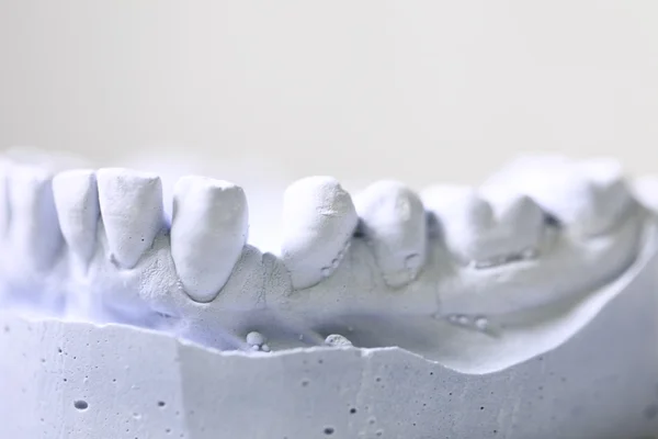 Стоматолог стоматологічної об'єктів — стокове фото