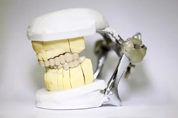 Objetos dentista dental —  Fotos de Stock