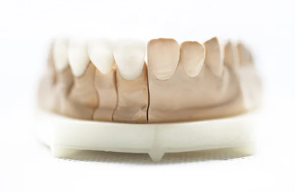 Dentista objetos dentários — Fotografia de Stock