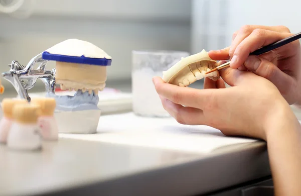 Dental tandläkare objekt — Stockfoto