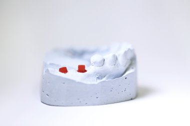 diş hekimi nesneleri