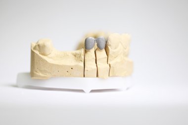 diş hekimi nesneleri