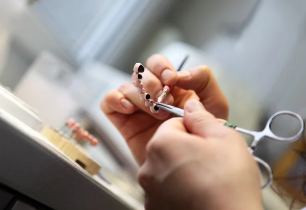 Oggetti dentistici — Foto Stock