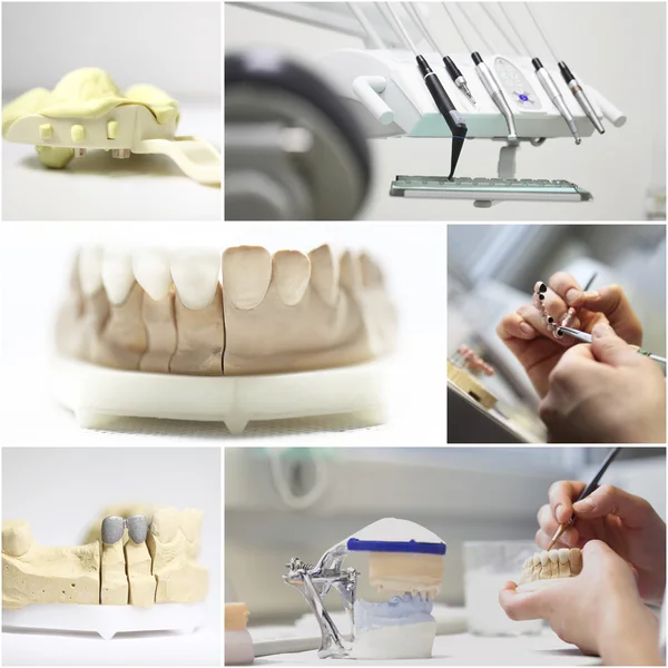 Dentista dental objetos collage — Foto de Stock
