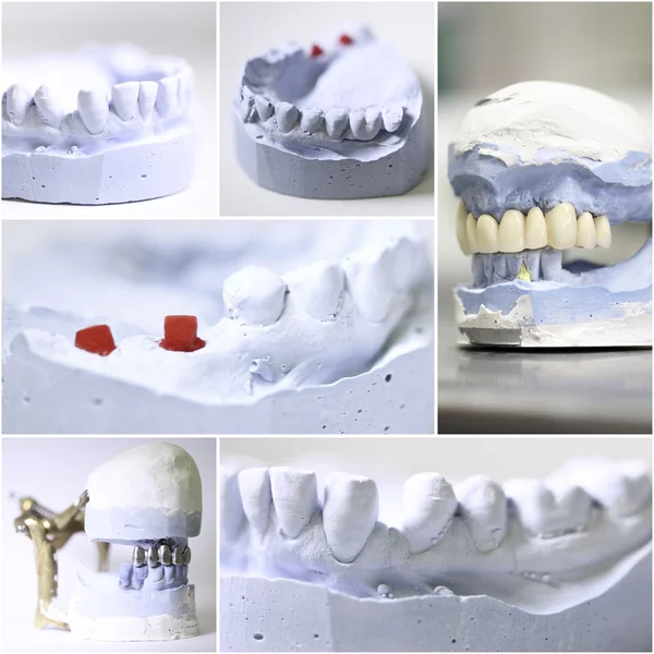 Dental dentist objects collage — Stock Photo, Image