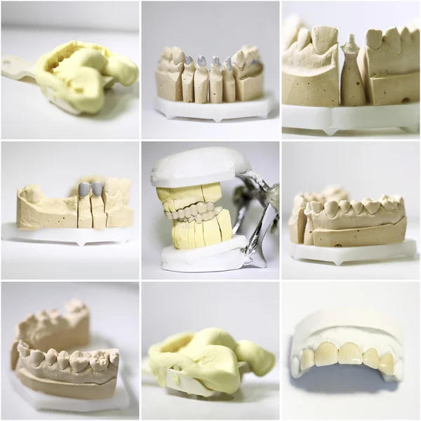 Dentista oggetti collage — Foto Stock