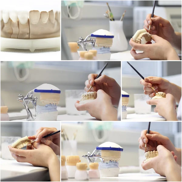 Dentista dental objetos collage — Foto de Stock
