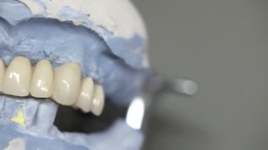 implantlar diş dişçi nesneleri