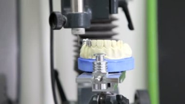 implantlar diş dişçi nesneleri