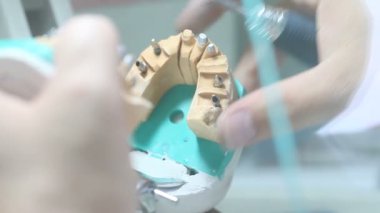 implantlar diş dişçi nesneleri