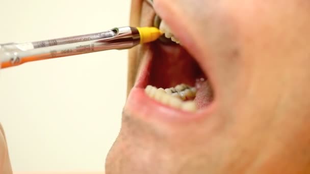 stříkačka zubní anestézii