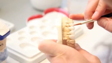 implantlar diş dişçi nesneleri