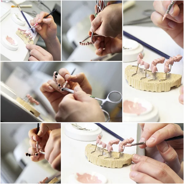 Dental tandläkare objekt collage — Stockfoto