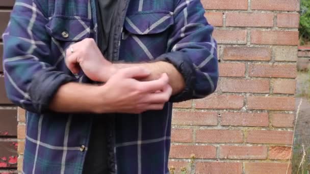 Man Scratching His Arm — Stockvideo