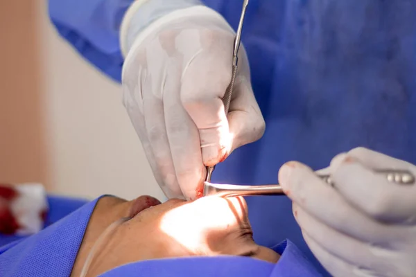 Closeup Doctor Performin Surgery Patient While Patientis Sedated — Stock Photo, Image